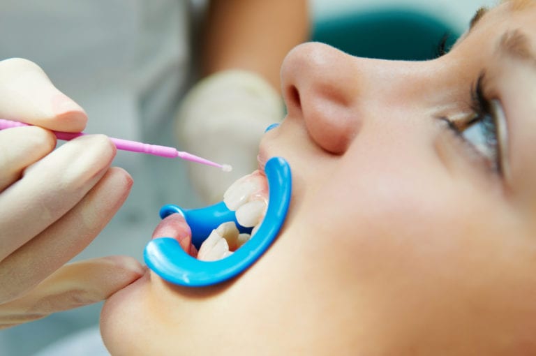 pediatric dentist examining baby teeth